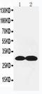 Collagen Type IV Alpha 2 Chain antibody, PA1521, Boster Biological Technology, Western Blot image 