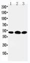 5-Hydroxytryptamine Receptor 3A antibody, PA1610, Boster Biological Technology, Western Blot image 