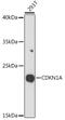 p21 antibody, 15-754, ProSci, Western Blot image 