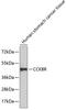 Cholecystokinin B Receptor antibody, 18-877, ProSci, Western Blot image 