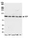 Valosin Containing Protein antibody, A300-589A, Bethyl Labs, Western Blot image 