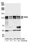 PHD Finger Protein 8 antibody, A301-772A, Bethyl Labs, Western Blot image 