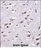Cellular Repressor Of E1A Stimulated Genes 2 antibody, PA5-48664, Invitrogen Antibodies, Immunohistochemistry paraffin image 