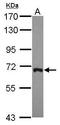ADP-ribosylation factor GTPase-activating protein 3 antibody, PA5-30515, Invitrogen Antibodies, Western Blot image 