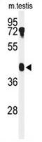 Beta-1,4-Galactosyltransferase 2 antibody, AP50331PU-N, Origene, Western Blot image 