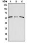 Arylsulfatase A antibody, orb213586, Biorbyt, Western Blot image 