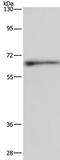 Elastin antibody, TA323639, Origene, Western Blot image 