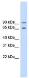 Voltage-dependent L-type calcium channel subunit beta-2 antibody, TA339049, Origene, Western Blot image 