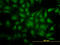 Y-Box Binding Protein 1 antibody, LS-B11709, Lifespan Biosciences, Immunofluorescence image 