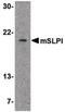 Secretory Leukocyte Peptidase Inhibitor antibody, PA5-20386, Invitrogen Antibodies, Western Blot image 