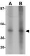 CD33 Molecule antibody, GTX31843, GeneTex, Western Blot image 