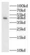 Regenerating Family Member 3 Gamma antibody, FNab04406, FineTest, Western Blot image 