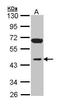 Inositol Polyphosphate-1-Phosphatase antibody, TA308486, Origene, Western Blot image 