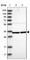 Zinc Finger Protein 124 antibody, HPA031127, Atlas Antibodies, Western Blot image 