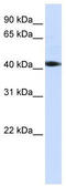 Serine/Threonine Kinase 17a antibody, TA330331, Origene, Western Blot image 
