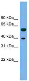 Major Facilitator Superfamily Domain Containing 12 antibody, TA335491, Origene, Western Blot image 