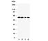 Cytochrome P450 Family 1 Subfamily A Member 2 antibody, R31007, NSJ Bioreagents, Western Blot image 