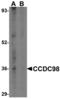 Abraxas 1, BRCA1 A Complex Subunit antibody, A32338, Boster Biological Technology, Western Blot image 