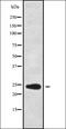 Ribosomal Protein L13a antibody, orb337922, Biorbyt, Western Blot image 