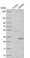 Chromosome 6 Open Reading Frame 62 antibody, PA5-56503, Invitrogen Antibodies, Western Blot image 