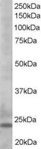 BCL2 Like 11 antibody, AHP2074, Bio-Rad (formerly AbD Serotec) , Western Blot image 