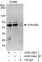 Chromosome 18 Open Reading Frame 25 antibody, A303-394A, Bethyl Labs, Immunoprecipitation image 