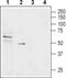 Solute Carrier Family 22 Member 1 antibody, PA5-77387, Invitrogen Antibodies, Western Blot image 