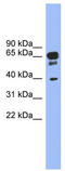 5-Hydroxytryptamine Receptor 5A antibody, TA331757, Origene, Western Blot image 