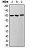 Aryl hydrocarbon receptor antibody, MBS829549, MyBioSource, Western Blot image 