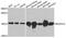 NADH:Ubiquinone Oxidoreductase Subunit A12 antibody, A10519, Boster Biological Technology, Western Blot image 