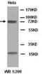 WEE1 G2 Checkpoint Kinase antibody, orb77227, Biorbyt, Western Blot image 