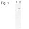 PDE6B antibody, NB120-5663, Novus Biologicals, Western Blot image 