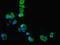 Creatine kinase U-type, mitochondrial antibody, LS-C212077, Lifespan Biosciences, Immunofluorescence image 