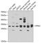 Dolichyl-Phosphate Mannosyltransferase Subunit 1, Catalytic antibody, GTX33163, GeneTex, Western Blot image 