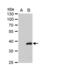 Chitinase 3 Like 2 antibody, NBP1-33193, Novus Biologicals, Western Blot image 
