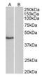TATA-Box Binding Protein antibody, orb12374, Biorbyt, Western Blot image 