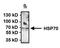 Heat shock 70 kDa protein 1A/1B antibody, MA3-008, Invitrogen Antibodies, Immunoprecipitation image 