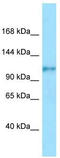 FCRH5 antibody, TA343079, Origene, Western Blot image 
