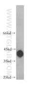 Bardet-Biedl Syndrome 5 antibody, 14569-1-AP, Proteintech Group, Western Blot image 