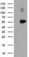 Sequestosome-1 antibody, TA502131, Origene, Western Blot image 