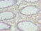 Zinc Finger Protein 490 antibody, A61954-100, Epigentek, Immunohistochemistry paraffin image 