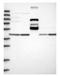 Piezo Type Mechanosensitive Ion Channel Component 2 antibody, NBP1-89892, Novus Biologicals, Western Blot image 
