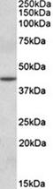 Deltex E3 Ubiquitin Ligase 3L antibody, orb67182, Biorbyt, Western Blot image 