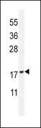 Phospholipase A2 Group IID antibody, LS-C163758, Lifespan Biosciences, Western Blot image 