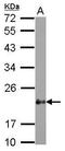 Cysteine And Glycine Rich Protein 2 antibody, GTX117848, GeneTex, Western Blot image 