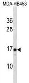 Lens Intrinsic Membrane Protein 2 antibody, LS-C165773, Lifespan Biosciences, Western Blot image 