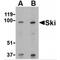 Ski oncogene antibody, MBS150393, MyBioSource, Western Blot image 