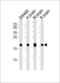 Visinin Like 1 antibody, 58-188, ProSci, Western Blot image 