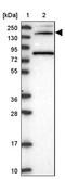 PTPRF Interacting Protein Alpha 3 antibody, PA5-60420, Invitrogen Antibodies, Western Blot image 