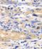 SARS antibody, FNab07609, FineTest, Immunohistochemistry frozen image 